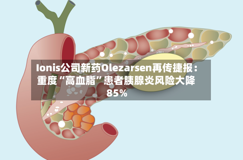 Ionis公司新药Olezarsen再传捷报：重度“高血脂	”患者胰腺炎风险大降85%-第2张图片