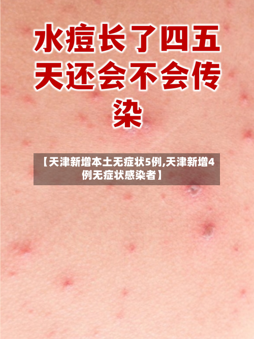 【天津新增本土无症状5例,天津新增4例无症状感染者】-第2张图片