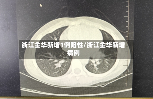 浙江金华新增1例阳性/浙江金华新增病例-第3张图片