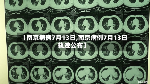 【南京病例7月13日,南京病例7月13日轨迹公布】-第2张图片