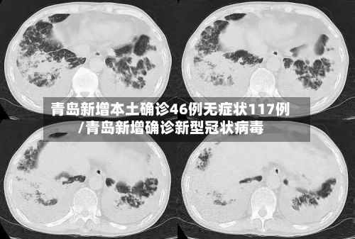 青岛新增本土确诊46例无症状117例/青岛新增确诊新型冠状病毒-第2张图片