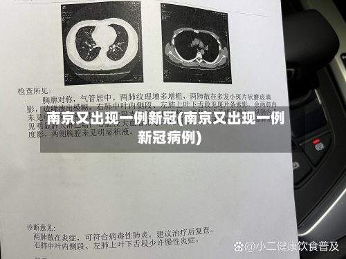 南京又出现一例新冠(南京又出现一例新冠病例)-第3张图片
